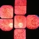 Retinitis Pigmentosa with arteriolar narrowing